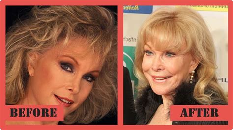 barbara eden nose job|barbara eden facelift.